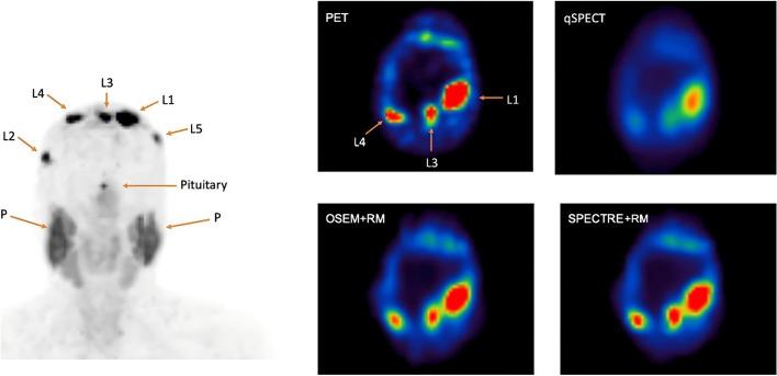 https://cdn.ncbi.nlm.nih.gov/pmc/blobs/6a9a/11782768/9c8a2ee02c21/40658_2025_724_Fig4_HTML.jpg