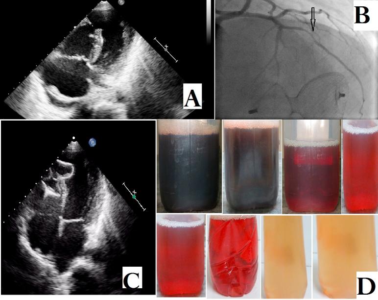 https://cdn.ncbi.nlm.nih.gov/pmc/blobs/6aa5/5067760/d0796e4ededc/gr1.jpg