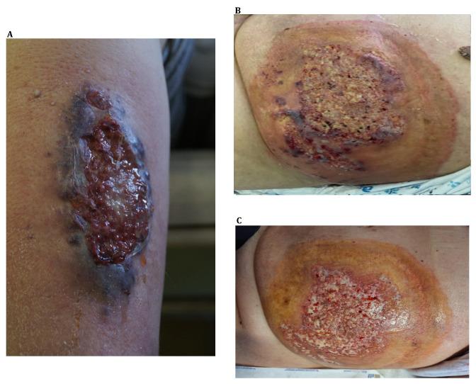 https://cdn.ncbi.nlm.nih.gov/pmc/blobs/6aa9/10889749/54c4775d6d49/ijms-25-02440-g001.jpg