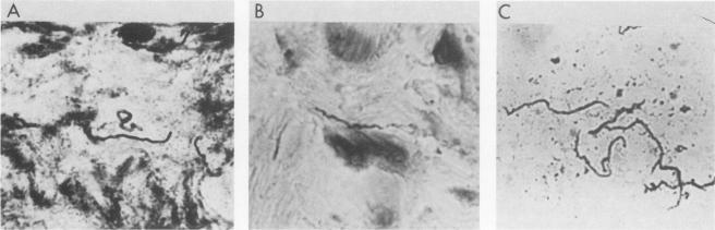 https://cdn.ncbi.nlm.nih.gov/pmc/blobs/6aad/261456/57303127cd48/iai00121-0230-a.jpg