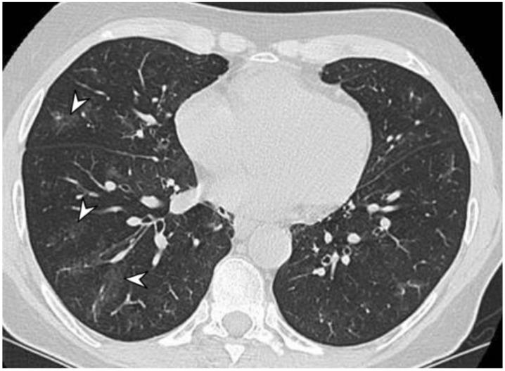 https://cdn.ncbi.nlm.nih.gov/pmc/blobs/6aad/8700038/2df2556c5089/diagnostics-11-02318-g003.jpg