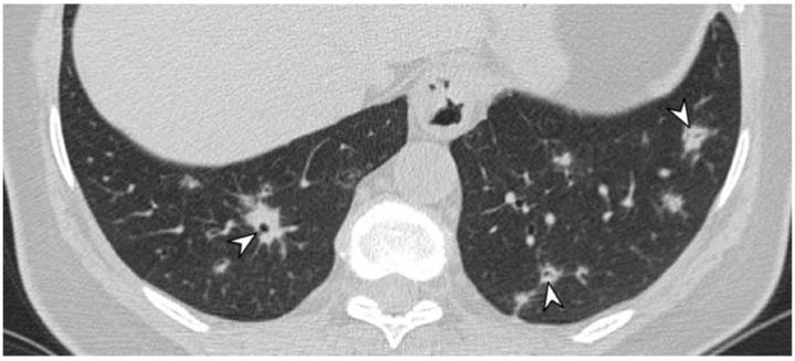 https://cdn.ncbi.nlm.nih.gov/pmc/blobs/6aad/8700038/30f4a2b419c7/diagnostics-11-02318-g006.jpg