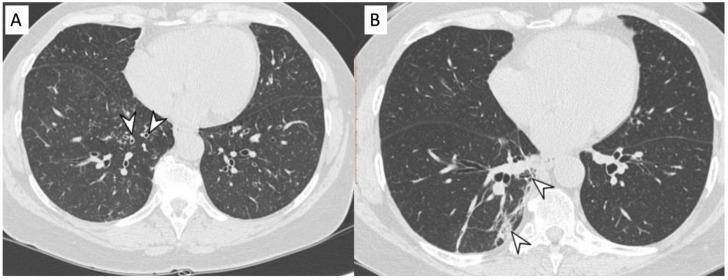 https://cdn.ncbi.nlm.nih.gov/pmc/blobs/6aad/8700038/9bffc4c9d9b6/diagnostics-11-02318-g004.jpg