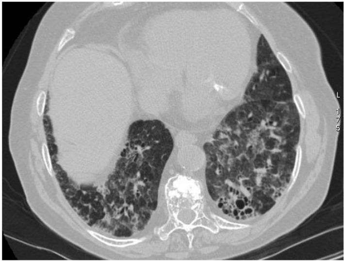 https://cdn.ncbi.nlm.nih.gov/pmc/blobs/6aad/8700038/a14b9a84ee32/diagnostics-11-02318-g014.jpg