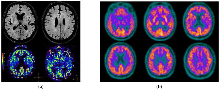 https://cdn.ncbi.nlm.nih.gov/pmc/blobs/6ab4/9605211/cdf562d5af43/jpm-12-01665-g002.jpg