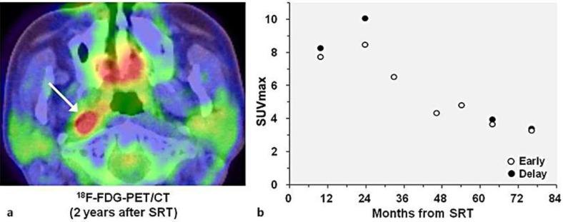 https://cdn.ncbi.nlm.nih.gov/pmc/blobs/6ab5/4164066/30a6d193362f/cro-0007-0576-g02.jpg
