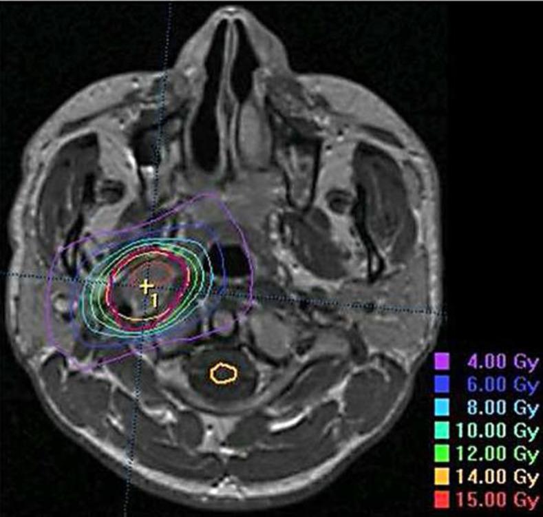 https://cdn.ncbi.nlm.nih.gov/pmc/blobs/6ab5/4164066/aeb6e801d9de/cro-0007-0576-g01.jpg