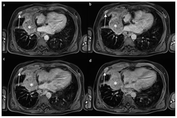 https://cdn.ncbi.nlm.nih.gov/pmc/blobs/6ac4/8946868/a0bb51f1fb83/diagnostics-12-00750-g003.jpg
