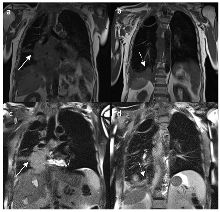 https://cdn.ncbi.nlm.nih.gov/pmc/blobs/6ac4/8946868/d33071826e94/diagnostics-12-00750-g002.jpg