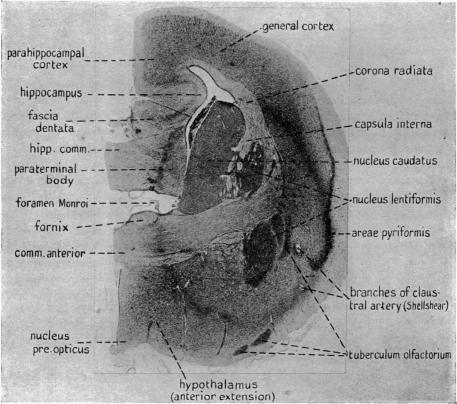 https://cdn.ncbi.nlm.nih.gov/pmc/blobs/6ac7/1262924/4de5a06da3e7/janat00594-0007-a.jpg