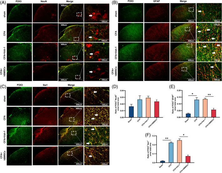 https://cdn.ncbi.nlm.nih.gov/pmc/blobs/6acd/10542618/723fa5a14361/CPR-56-e13461-g005.jpg