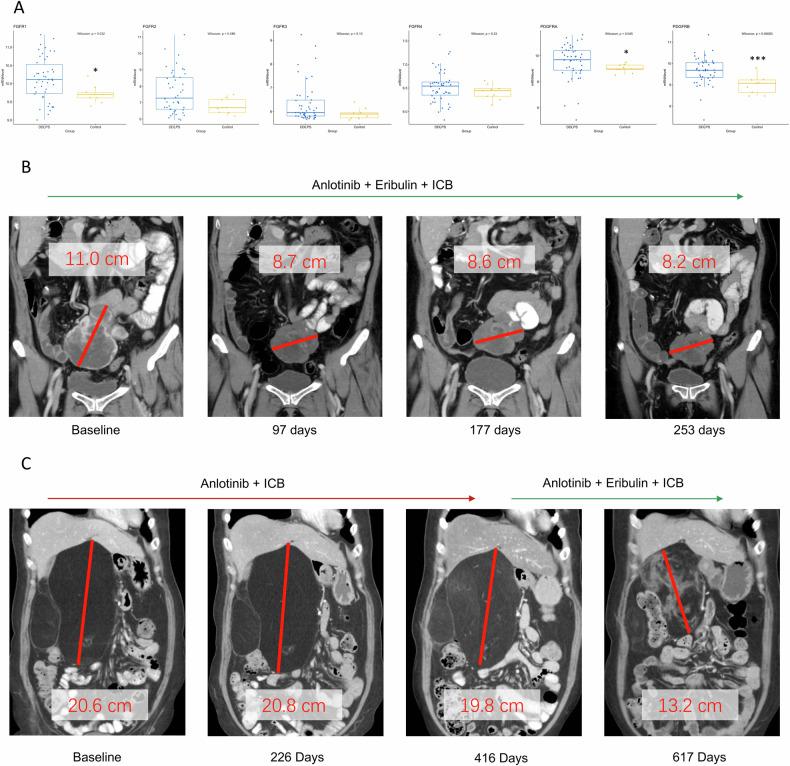 https://cdn.ncbi.nlm.nih.gov/pmc/blobs/6ace/11310505/844c58f6963f/41420_2024_2103_Fig1_HTML.jpg