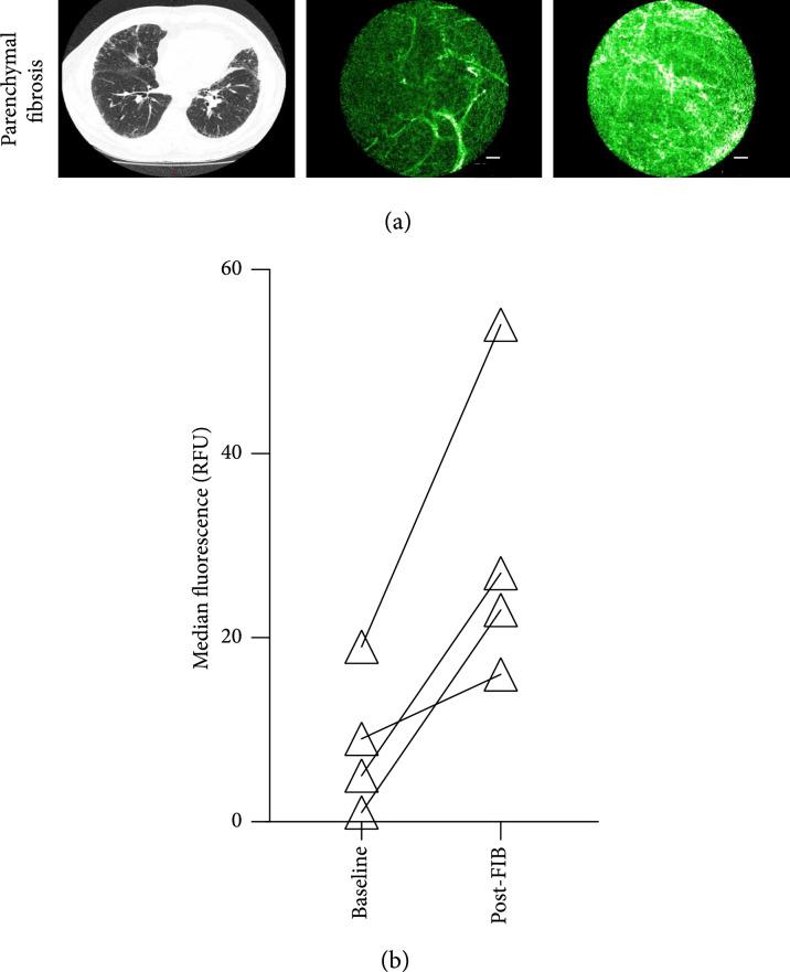https://cdn.ncbi.nlm.nih.gov/pmc/blobs/6ad0/10530652/1da3bbf4a770/9834163.fig.003.jpg