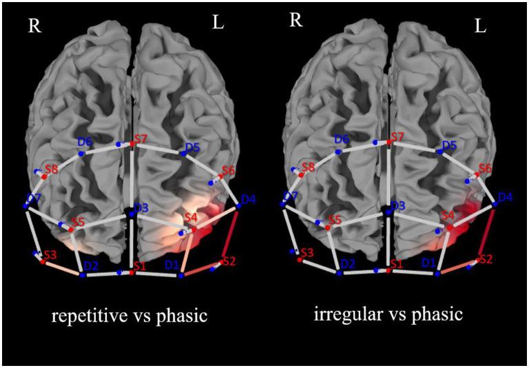 https://cdn.ncbi.nlm.nih.gov/pmc/blobs/6ad3/10790951/c47276754835/fnrgo-04-1266439-g0003.jpg