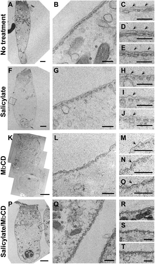 https://cdn.ncbi.nlm.nih.gov/pmc/blobs/6ada/4564264/ec68de2017b8/pgen.1005500.g006.jpg