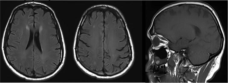 https://cdn.ncbi.nlm.nih.gov/pmc/blobs/6adf/12378558/114c3b2387ad/acaf027f1.jpg