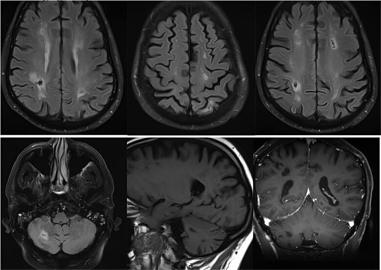 https://cdn.ncbi.nlm.nih.gov/pmc/blobs/6adf/12378558/d301cde33b0a/acaf027f2.jpg