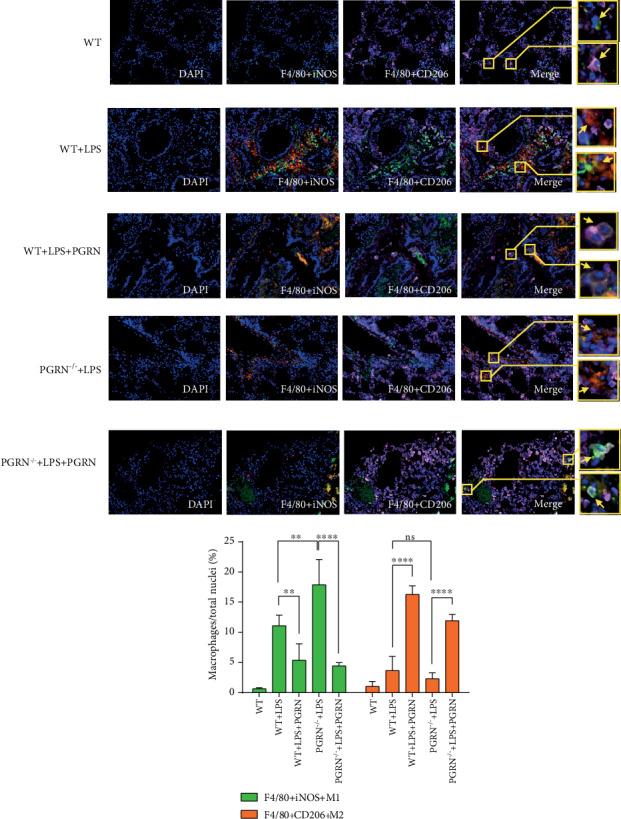https://cdn.ncbi.nlm.nih.gov/pmc/blobs/6adf/7281846/a95e18e3b889/MI2020-9704327.004.jpg