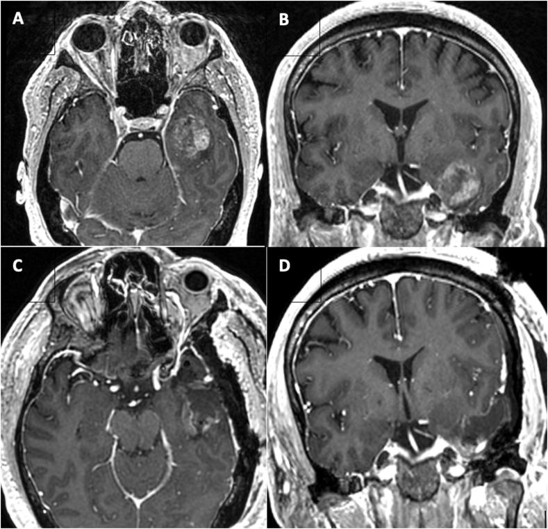 https://cdn.ncbi.nlm.nih.gov/pmc/blobs/6af0/10344792/1ff9633a10a0/gr2.jpg