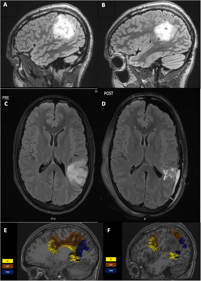 https://cdn.ncbi.nlm.nih.gov/pmc/blobs/6af0/10344792/8b14fc70979f/gr3.jpg