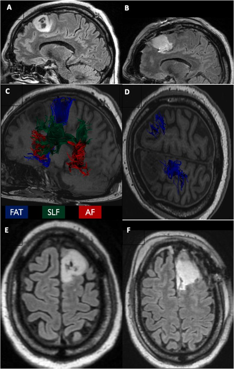 https://cdn.ncbi.nlm.nih.gov/pmc/blobs/6af0/10344792/9b507c749ba9/gr1.jpg