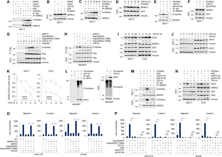 https://cdn.ncbi.nlm.nih.gov/pmc/blobs/6af3/8991186/0db533fbad8d/41418_2021_901_Fig4_HTML.jpg