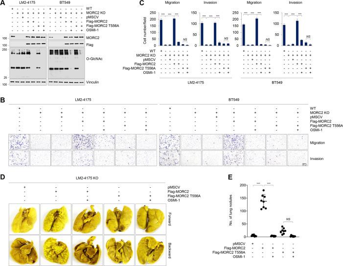 https://cdn.ncbi.nlm.nih.gov/pmc/blobs/6af3/8991186/fcf0ff1743fb/41418_2021_901_Fig3_HTML.jpg