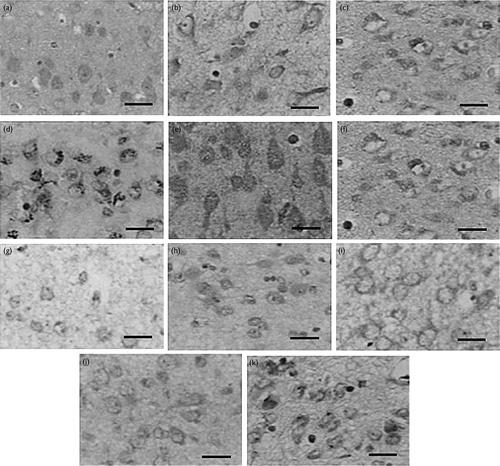 https://cdn.ncbi.nlm.nih.gov/pmc/blobs/6afa/6392204/6148bd2ef97b/wnr-30-262-g002.jpg