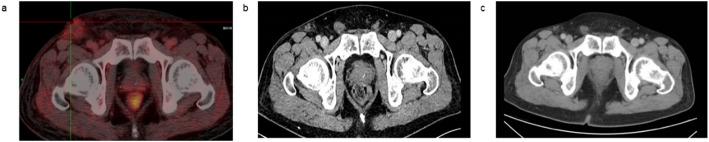 https://cdn.ncbi.nlm.nih.gov/pmc/blobs/6aff/12301285/85e98fd1e863/12672_2025_3097_Fig4_HTML.jpg