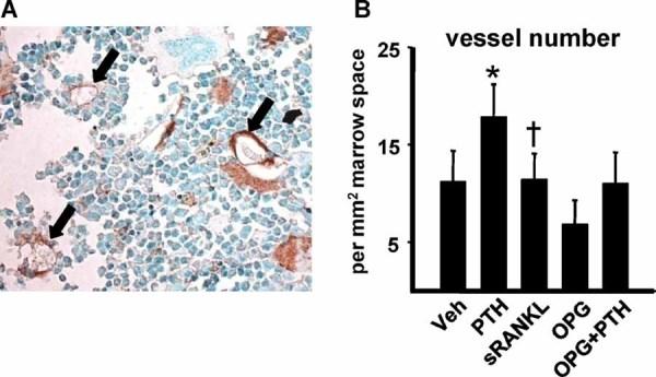 https://cdn.ncbi.nlm.nih.gov/pmc/blobs/6b03/3179285/ca33a6676525/jbmr0025-2427-f6.jpg