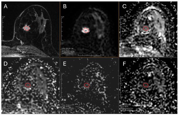 https://cdn.ncbi.nlm.nih.gov/pmc/blobs/6b04/12385855/6e1f21a3c8e6/diagnostics-15-02033-g001.jpg