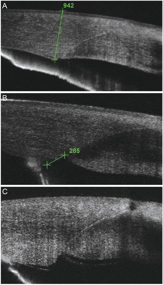 https://cdn.ncbi.nlm.nih.gov/pmc/blobs/6b05/4309865/d9919f47b3a8/kjo-29-23-g001.jpg