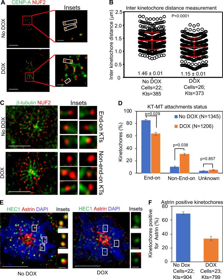 https://cdn.ncbi.nlm.nih.gov/pmc/blobs/6b07/7905998/d272f45e37ea/JCB_202007195_Fig4.jpg