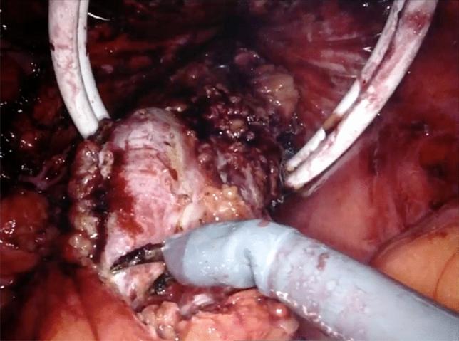 https://cdn.ncbi.nlm.nih.gov/pmc/blobs/6b07/8116298/f96501ece581/464_2021_8350_Fig5_HTML.jpg