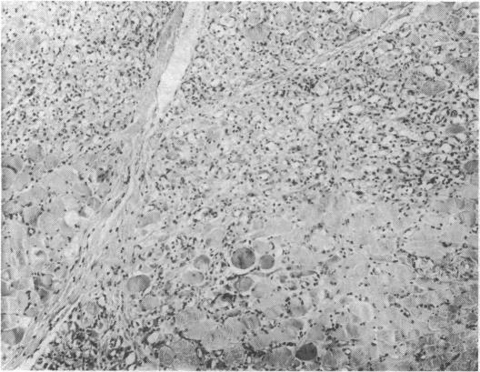https://cdn.ncbi.nlm.nih.gov/pmc/blobs/6b0b/1675252/450f12a5f7ce/brmedj01474-0020-a.jpg