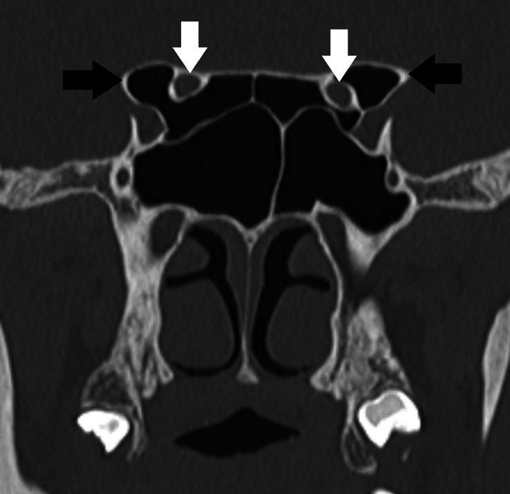 https://cdn.ncbi.nlm.nih.gov/pmc/blobs/6b10/10923376/9f369386d862/ms9-86-1309-g006.jpg