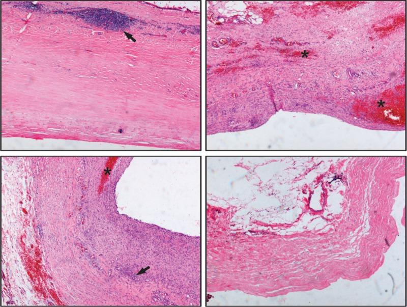 https://cdn.ncbi.nlm.nih.gov/pmc/blobs/6b15/4902365/86d11499636f/medi-95-e3751-g006.jpg