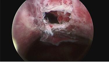 https://cdn.ncbi.nlm.nih.gov/pmc/blobs/6b16/8158849/5ab0fbb6bb31/rjab180f3.jpg