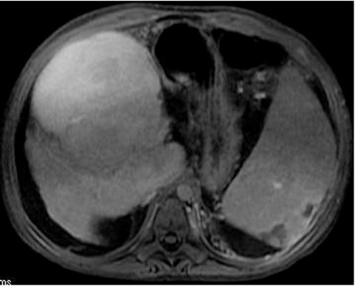 https://cdn.ncbi.nlm.nih.gov/pmc/blobs/6b19/4916051/30214fca80aa/gr5.jpg