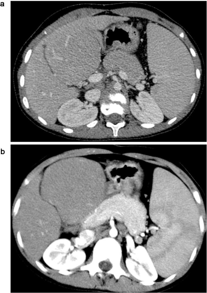https://cdn.ncbi.nlm.nih.gov/pmc/blobs/6b19/4916051/9899d5f20f04/gr2.jpg
