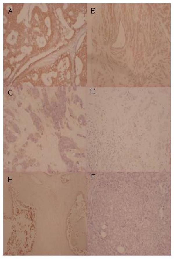 https://cdn.ncbi.nlm.nih.gov/pmc/blobs/6b2f/2702392/1018ef714e65/1471-2407-9-185-1.jpg