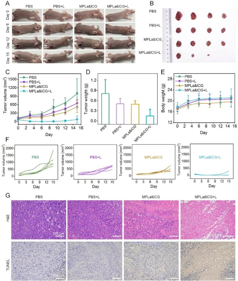 https://cdn.ncbi.nlm.nih.gov/pmc/blobs/6b32/11405823/18fd7cde11e8/gr6.jpg