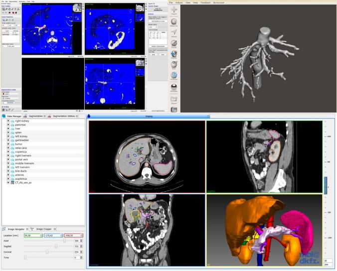 https://cdn.ncbi.nlm.nih.gov/pmc/blobs/6b35/11078809/046c0935ada3/464_2023_10615_Fig1_HTML.jpg