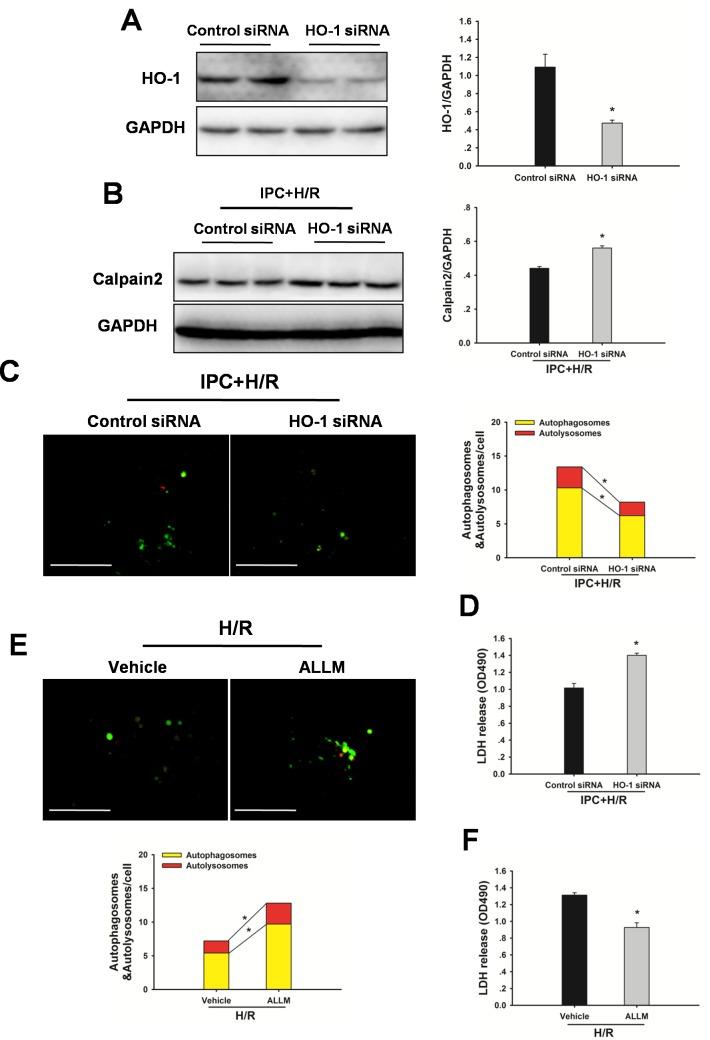 https://cdn.ncbi.nlm.nih.gov/pmc/blobs/6b37/5346646/b214400320d7/oncotarget-07-78372-g007.jpg