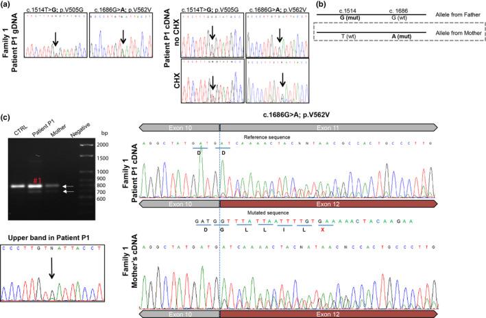 https://cdn.ncbi.nlm.nih.gov/pmc/blobs/6b38/7667330/22eaf0849ea9/MGG3-8-e1451-g002.jpg