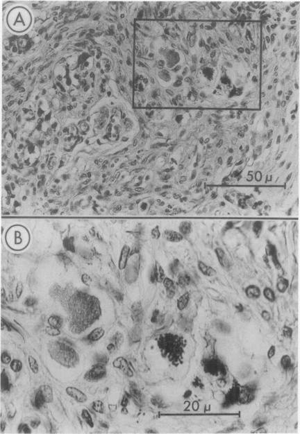 https://cdn.ncbi.nlm.nih.gov/pmc/blobs/6b43/2376464/7fdc5f0328b1/tacca00088-0149-a.jpg