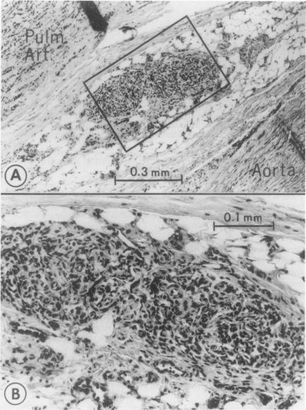 https://cdn.ncbi.nlm.nih.gov/pmc/blobs/6b43/2376464/8ee45dba041b/tacca00088-0153-a.jpg
