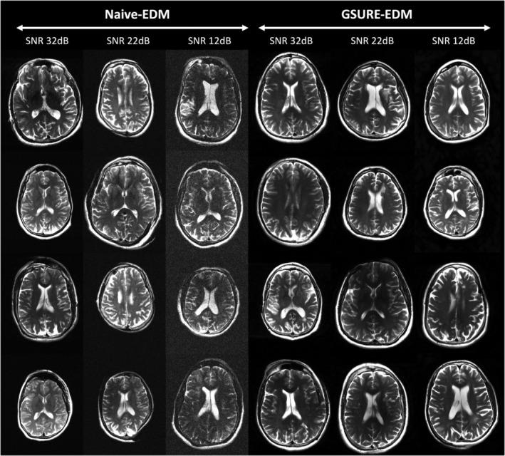 https://cdn.ncbi.nlm.nih.gov/pmc/blobs/6b45/12393204/0406db24dcae/MRM-94-1859-g008.jpg