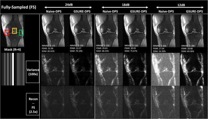 https://cdn.ncbi.nlm.nih.gov/pmc/blobs/6b45/12393204/1f07dca44700/MRM-94-1859-g002.jpg