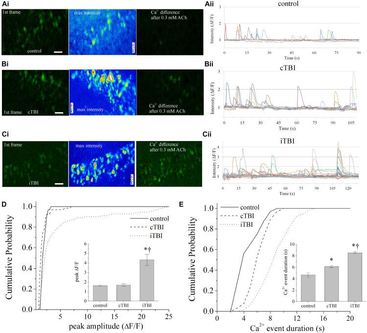 https://cdn.ncbi.nlm.nih.gov/pmc/blobs/6b46/8416999/d0ec44aad775/fnins-15-681144-g004.jpg